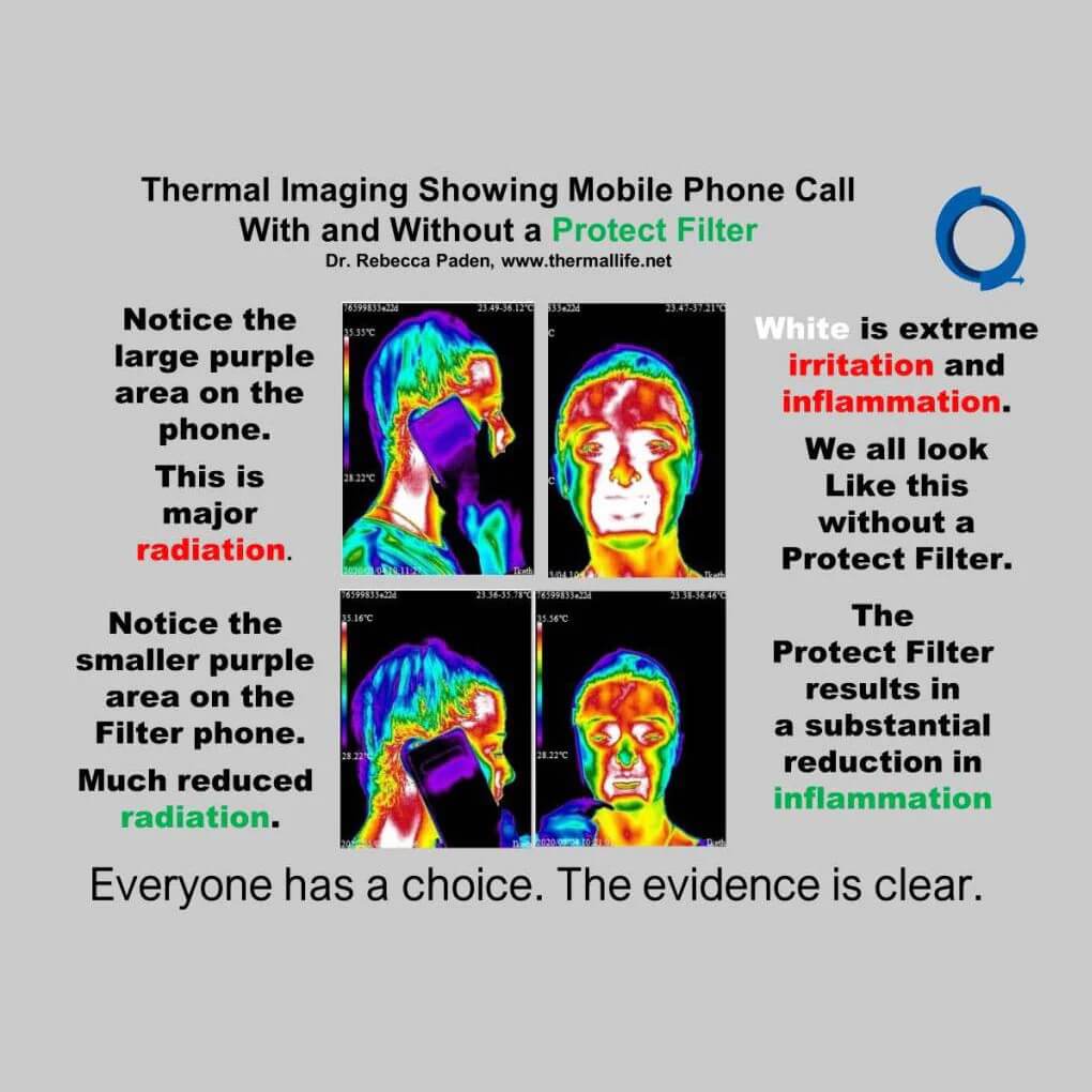 A series of thermal images comparing a mobile phone call with and without an EMF Protect Filter. The top scans show extreme heat and inflammation (white and purple areas) without a filter, while the bottom scans show a substantial reduction in thermal irritation, demonstrating how the AV Edge Cell Phone Protect Filter might provide a biological filter for mobile data and reduce phone radiation.